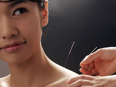 acupuncture-therapie2