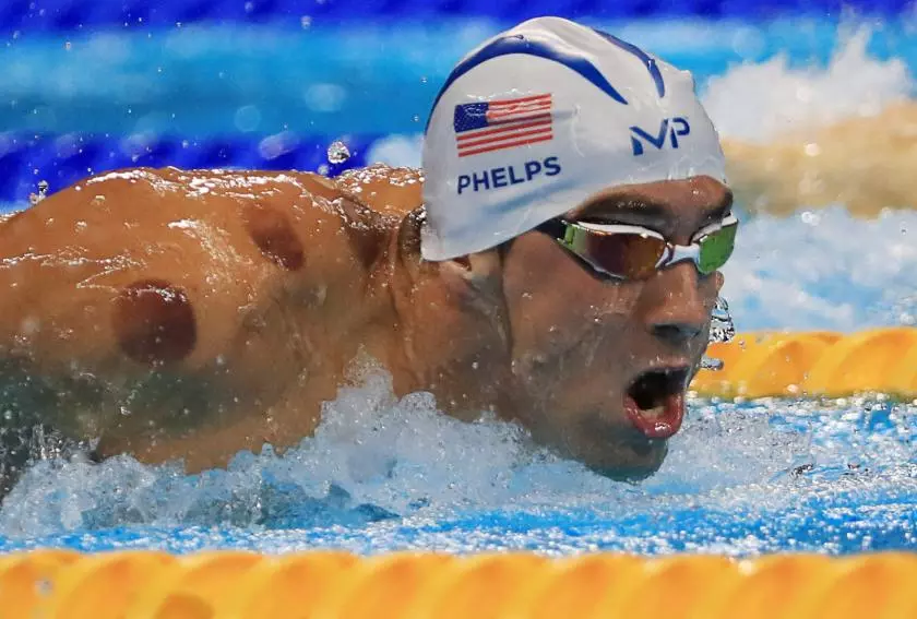 Cupping (utilisé par Michael Phelps aux jeux de Rio)